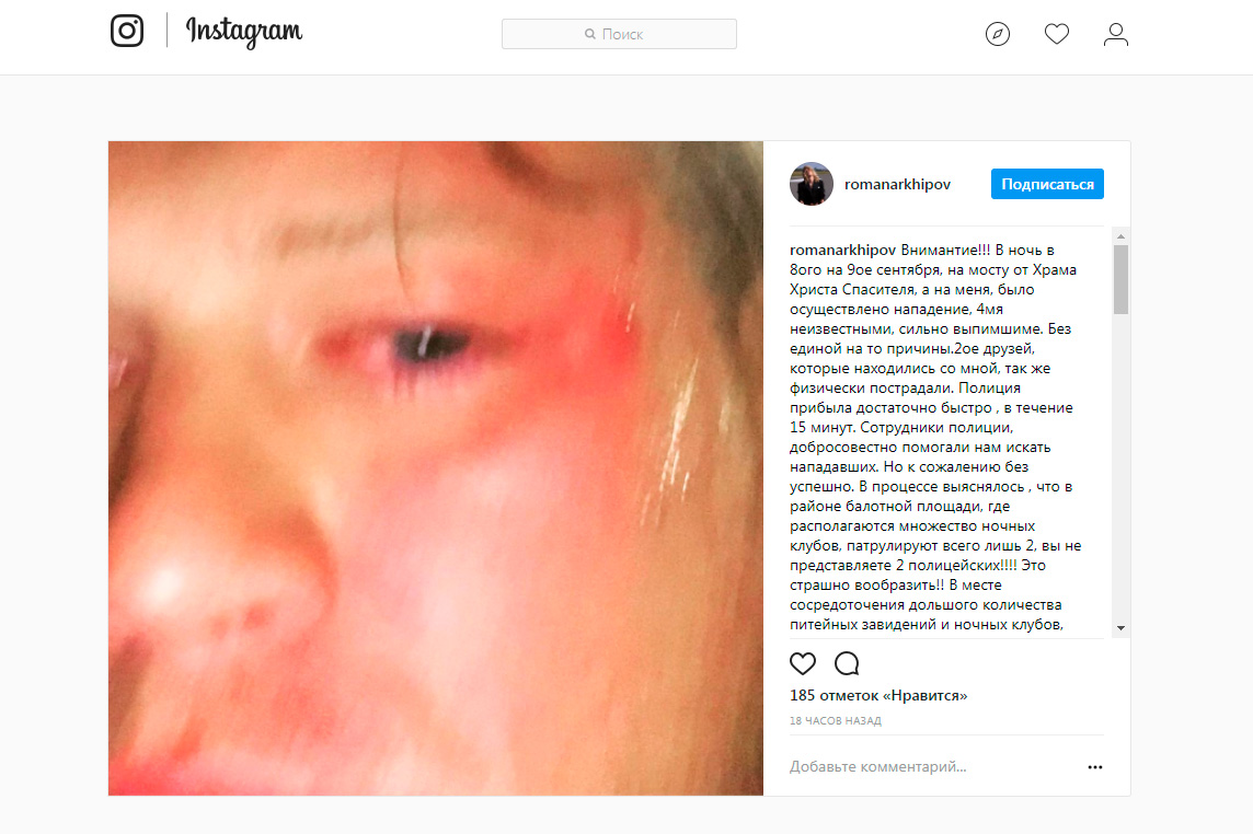 В центре Москвы избили певца Романа Архипова