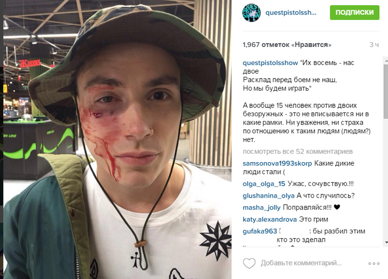 В центре Киева избили солиста Quest Pistols