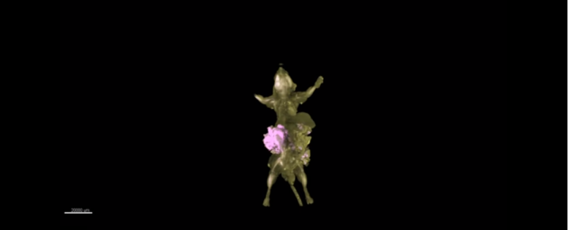 Новое слово в лечении рака: ученые создали инновационный метод сканирования