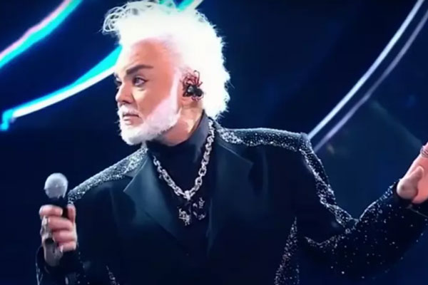 Липосакция, подтяжка лица и новые «кубики»: Киркоров рассказал, когда прекратит делать пластические операции