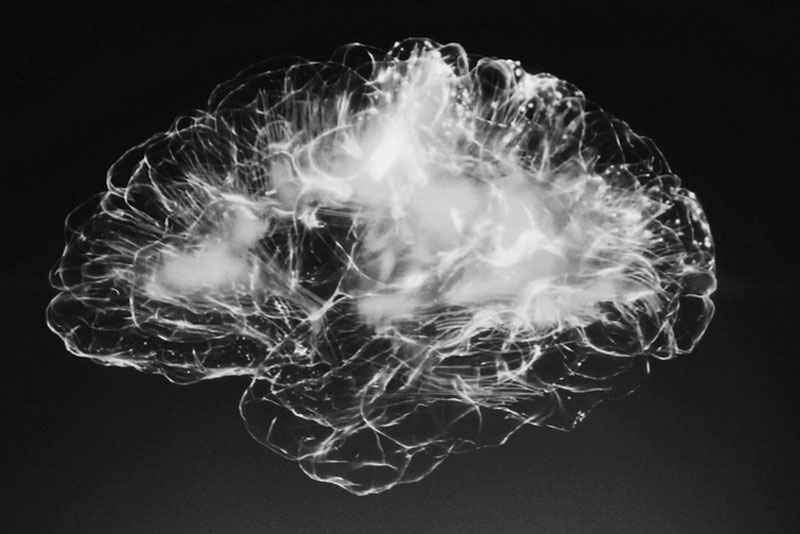 Нейробиологи первые в истории зафиксировали мозговую активность умирающего человека | Учёные впервые увидели, что происходит в мозге умирающего человека