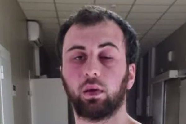 Житель Волгограда обвиняет полицейских в избиении, после которого попал в реанимацию