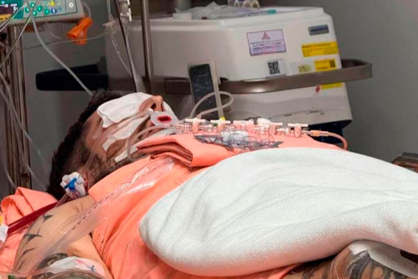 Менеджер Паши Техника сказал, что причиной смерти рэпера стала лёгочная инфекция | Стала известна причина смерти Паши Техника