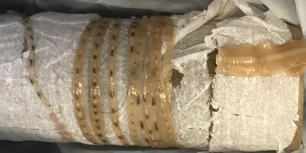 В США любитель суши вытащил из себя полутораметрового червя