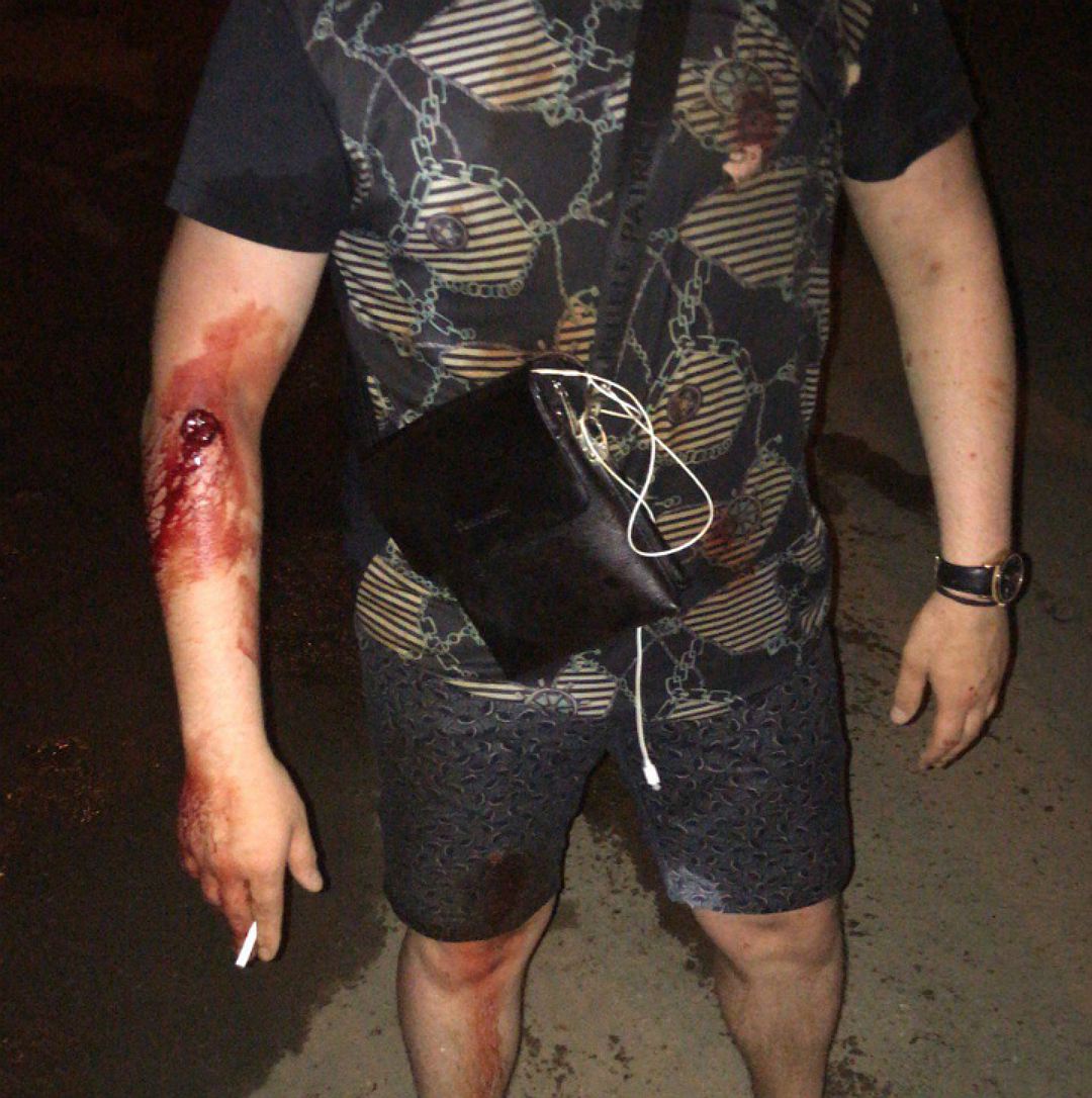 В Уфе произошла перестрелка: ранены двое