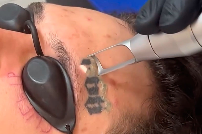 Алишер Моргенштерн* решает начать новую жизнь: рэпер удаляет татуировки с лица и все посты в Instagram** | Рэпер Моргенштерн* удаляет татуировки и очищает аккаунт в Instagram**