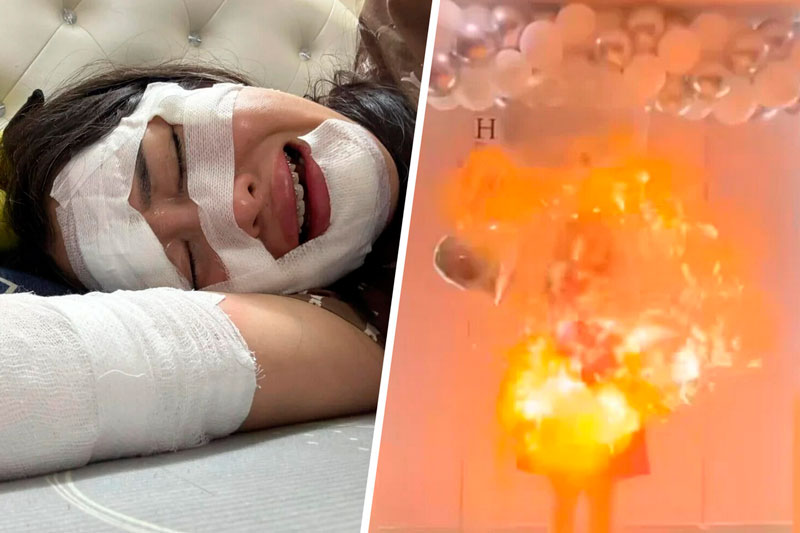 Во Вьетнаме женщина получила ожоги лица из-за взрыва шаров с водородом на дне рождения. Видео | Вьетнамская блогерша пострадала от взрыва шаров