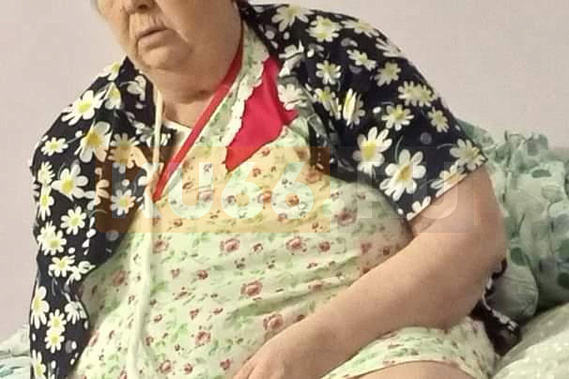 65-летняя жительница Свердловской области сломала руку во время УЗИ в платной клинике