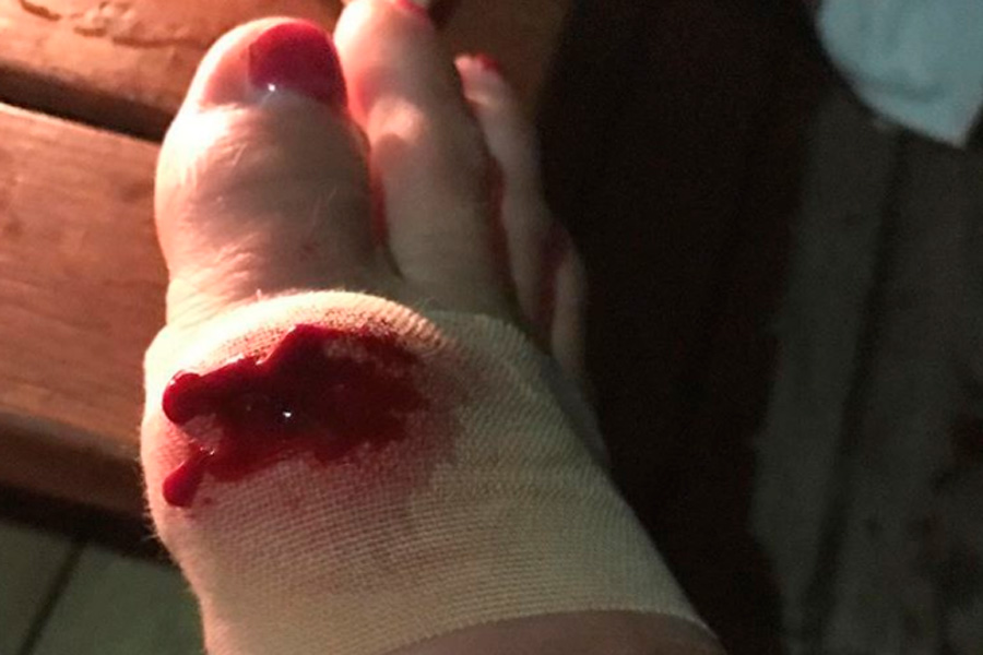 Врачи опасаются, что Волочкова лишится ног. Фото