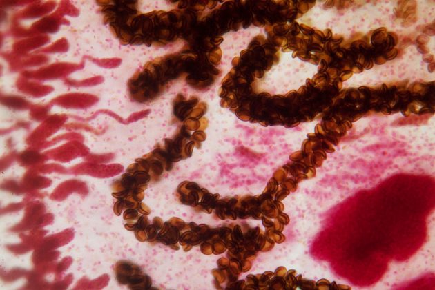 Доисторический паразит связан с повышение уровня моря и изменениями климата