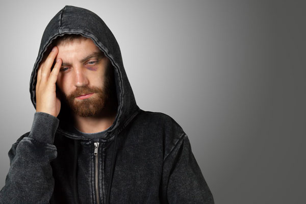 Йодные сетки не помогут: три способа уменьшить синяк